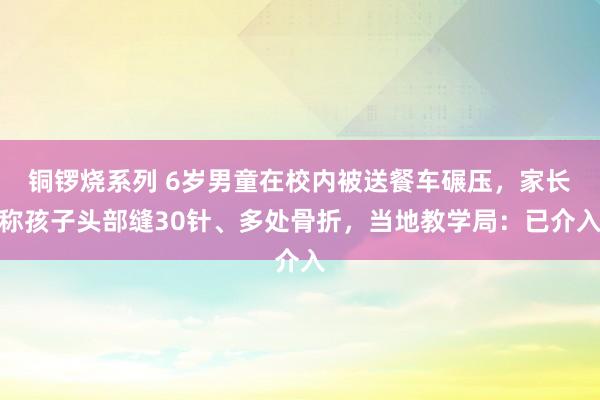 铜锣烧系列 6岁男童在校内被送餐车碾压，家长称孩子头部缝30针、多处骨折，当地教学局：已介入